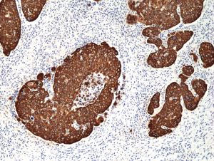 Immunohistochemical
