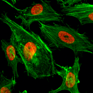 Immunocytochemistry