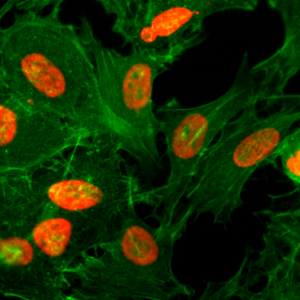 Immunocytochemistry