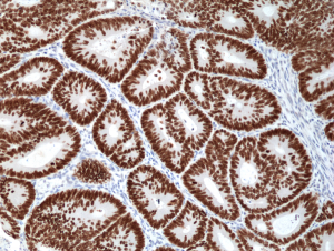 Immunohistochemical