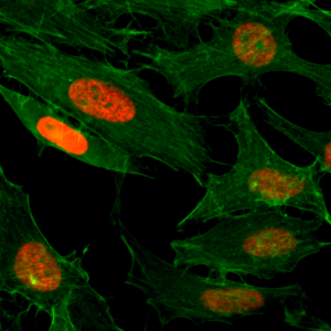 Immunocytochemistry