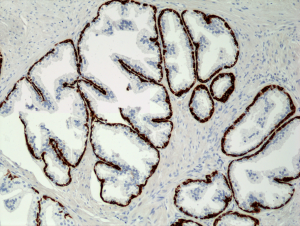 Immunohistochemical