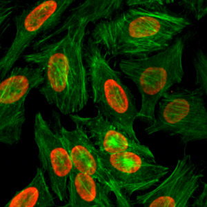 Immunocytochemistry