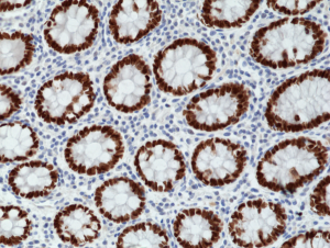 Immunohistochemical
