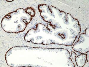 Immunohistochemical