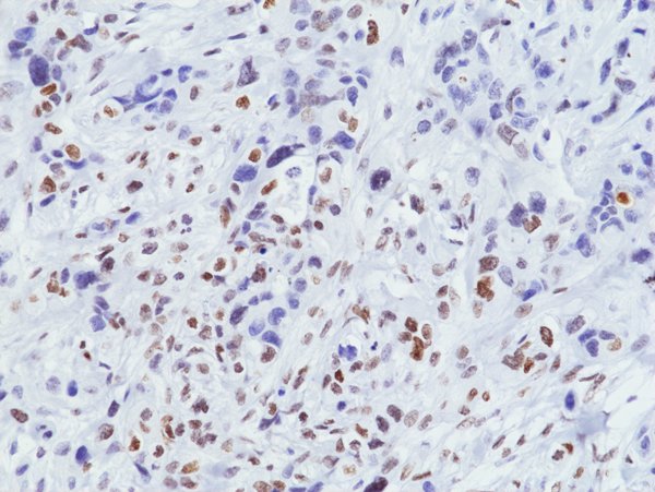 Anti-Trimethyl-Phospho-Histone H3 (Lys9/Ser10) Rabbit Monoclonal Antibody [Clone RM162]; H3K9me3S10ph; Histone H3 (trimethyl Lys9 phospho Ser10); 31-1097-00