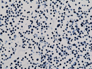 Immunohistochemistry