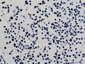 Immunohistochemistry