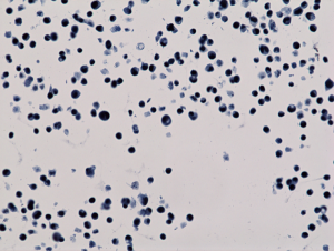 Immunohistochemistry