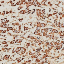 anti-KIR3DS1 / CD158e2 antibody