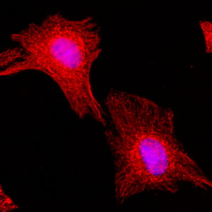 Immunocytochemical