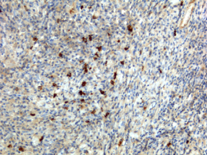 Immunohistochemistry