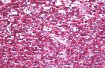 anti-CD45RB antibody [MEM-143]