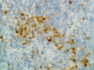 Immunohistochemistry