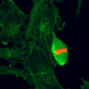 Immunocytochemistry