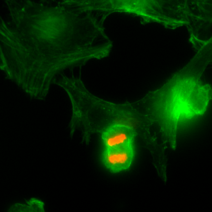 Immunocytochemistry