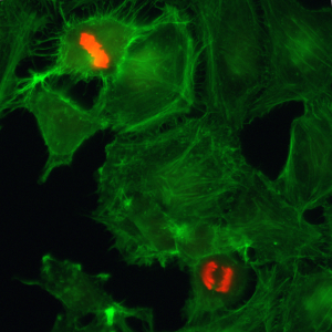 Immunocytochemistry