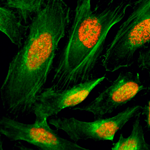 Immunocytochemistry