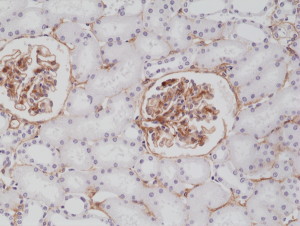 Immunohistochemical