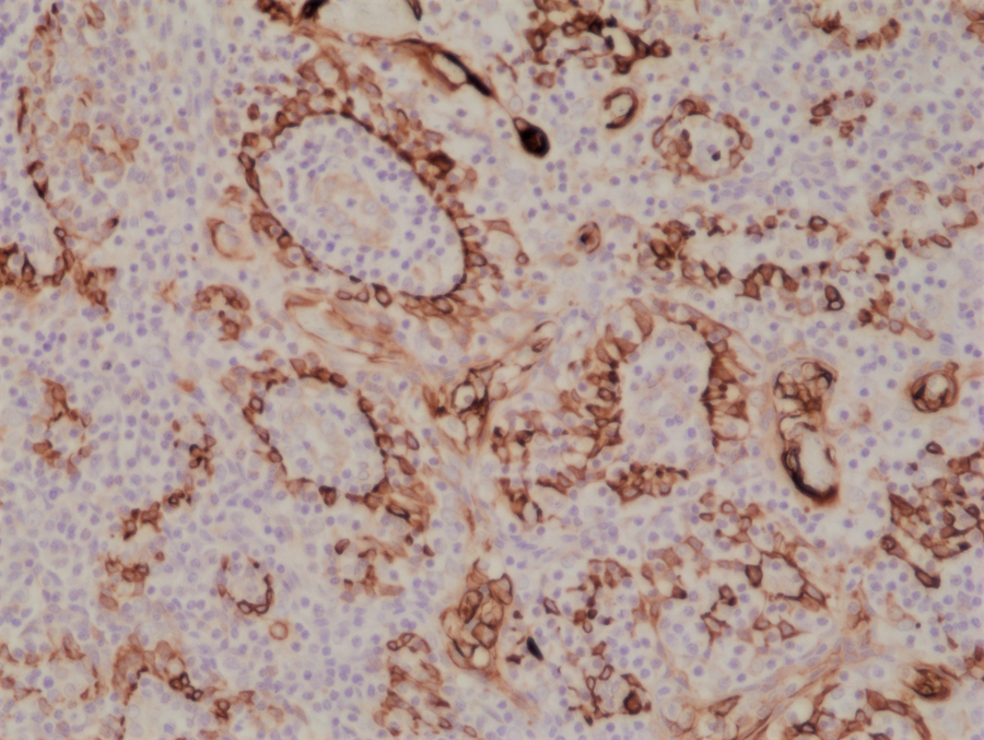 Anti-Cytokeratin 17 (CK-17) Rabbit Monoclonal Antibody [Clone RM351], 31-1237-00