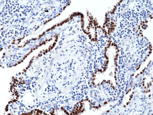 Immunohistochemical