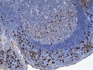 Immunohistochemistry
