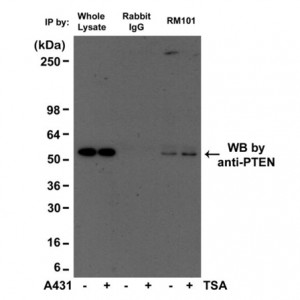 Immunoprecipitation