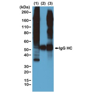 Immunoprecipitation