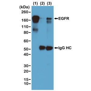 Immunoprecipitation