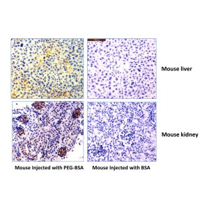 Immunohistochemistry
