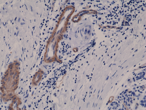 Immunohistochemical