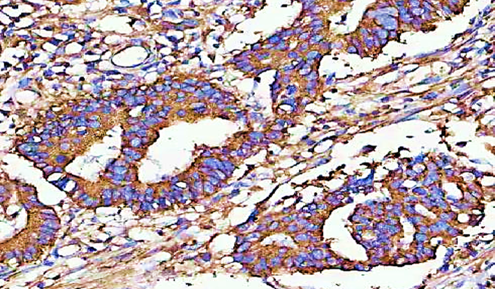 anti-MIA3 / TANGO1 antibody