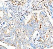 anti-MMS19 antibody